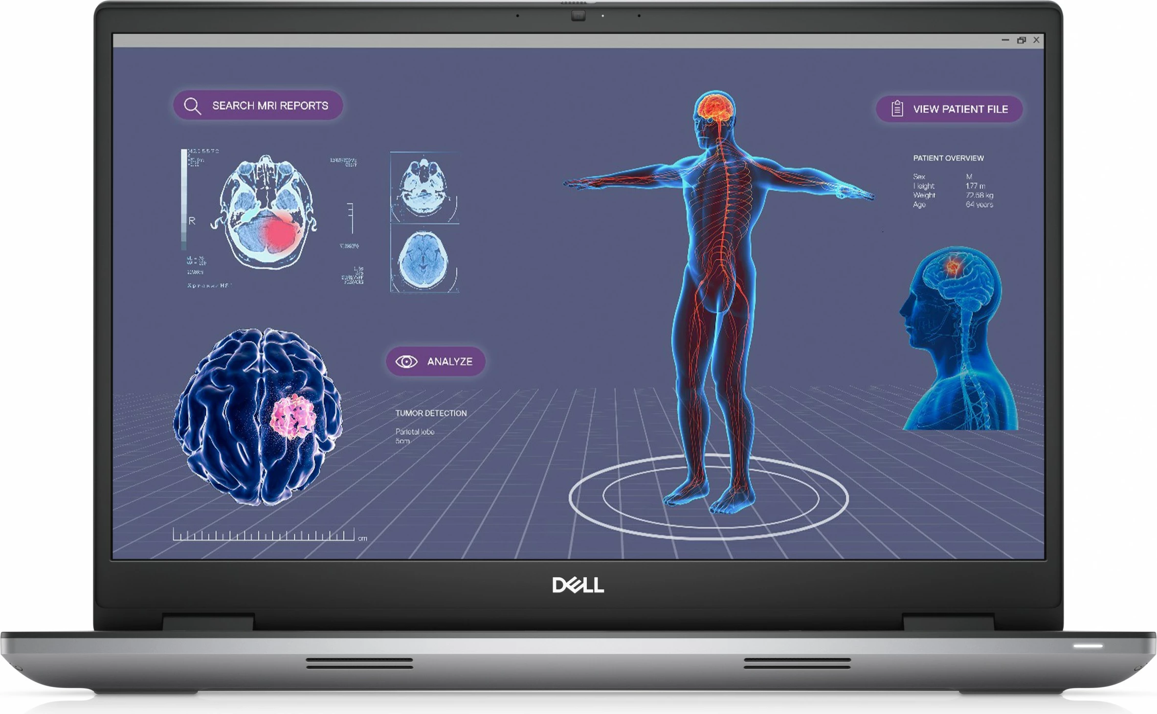 Zmogljiv prenosnik 17,3" DELL Precision 7780, Intel Core i7, 32 GB RAM, 1 TB, sivi