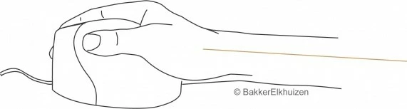 Ergonomska miška, Evoluent Evoluent4, 6 gumbov, za desno roko, črno/siva