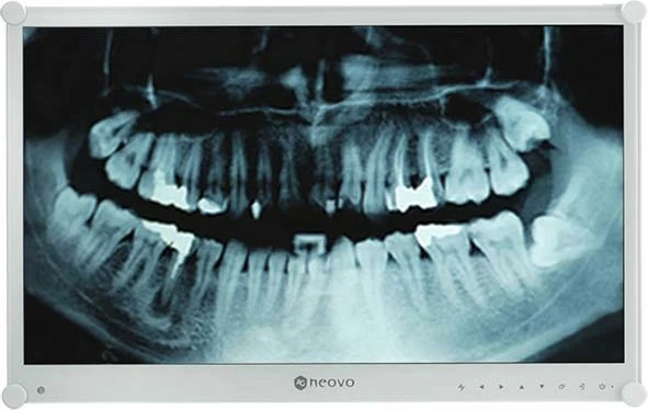 Dentalni monitor 23,8" Full HD, LCD, bel - AG Neovo DR-24G